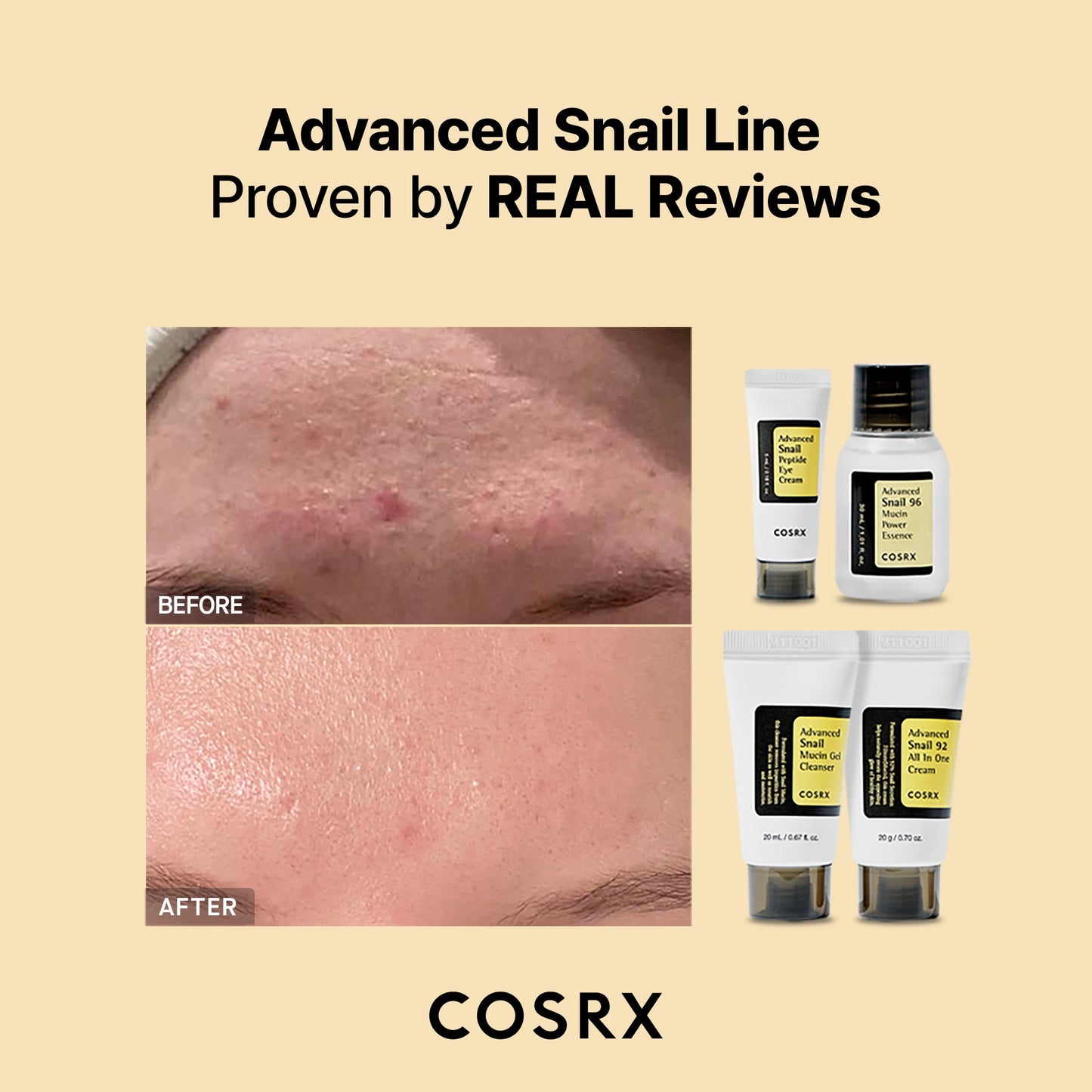 COSRX All about Snail Kit (4 Step)