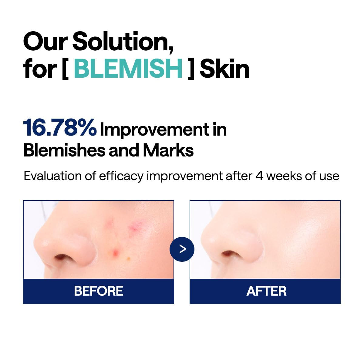 MEDIHEAL Madecassoside Toner Pads