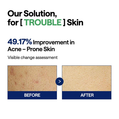 MEDIHEAL Teatree Trouble Facial Toner Pads (100 Pads)