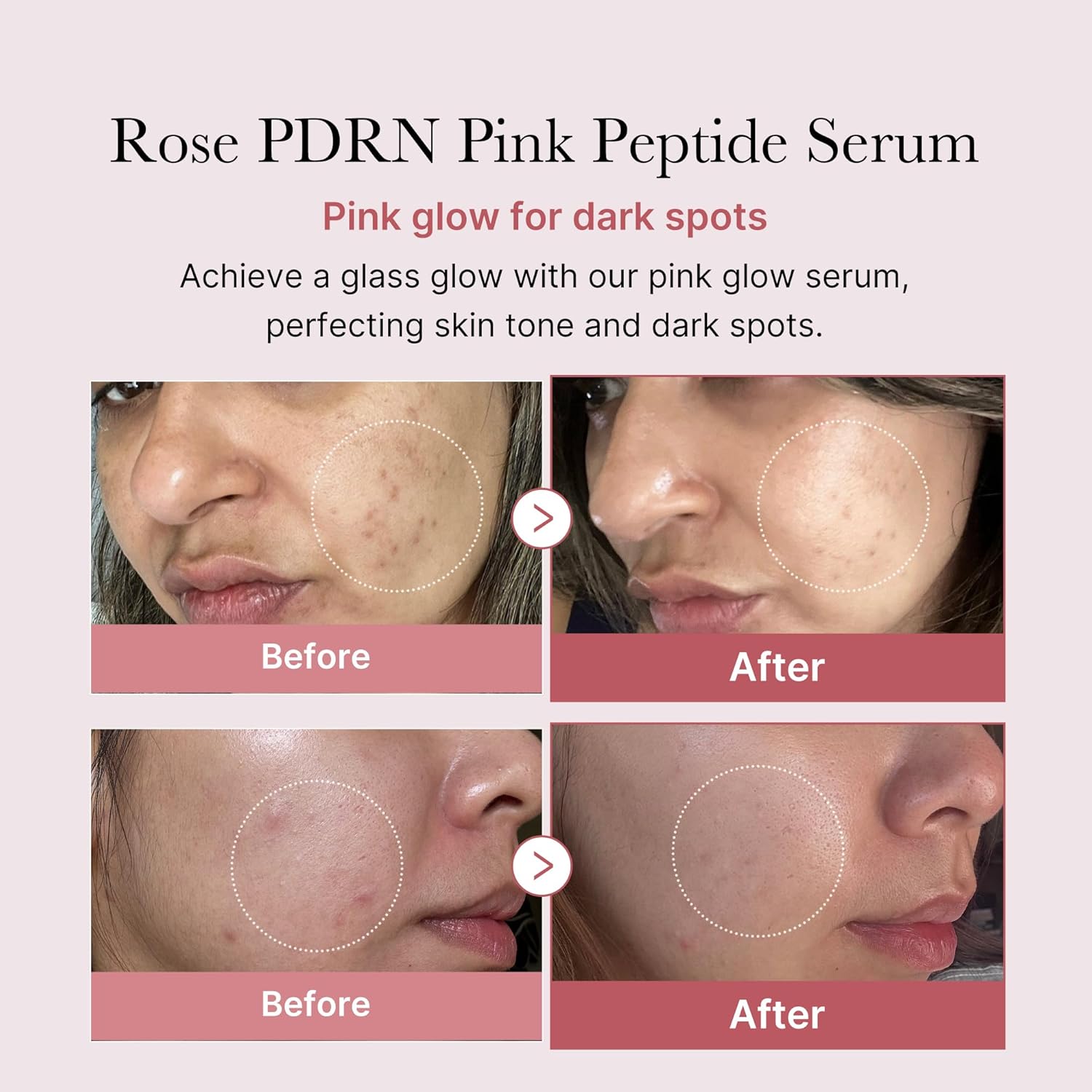 medicube PDRN Pink Peptide Serum (30mL)