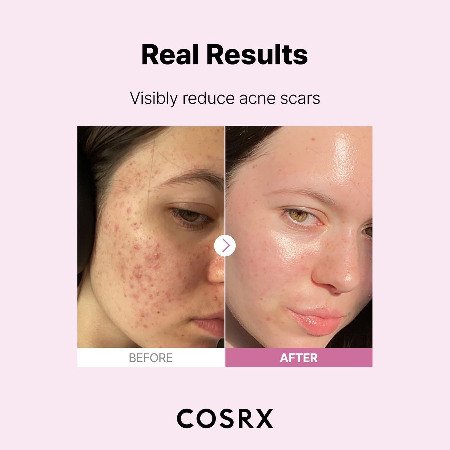 COSRX The Niacinamide 15 Serum (20mL)